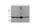 Anti-Human/Mouse/Rat GSTA1 Antibody - ABMIUM