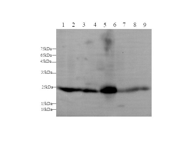 Anti-Human/Mouse/Rat GSTA1 Antibody - ABMIUM