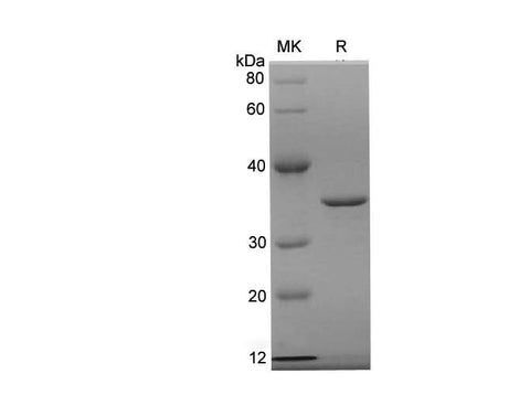 SDS-PAGE analysis of Human CDK4 proteins, 2 μg/lane of Recombinant Human CDK4 proteins was resolved with SDS-PAGE under reducing conditions, showing bands at 35.8 kDa.