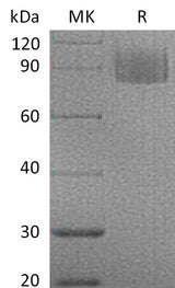 Recombinant Mouse MAG/Siglec-4a Protein (His Tag) - ABMIUM