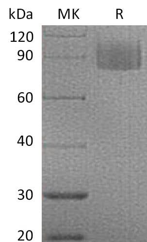 Recombinant Mouse MAG/Siglec-4a Protein (His Tag) - ABMIUM