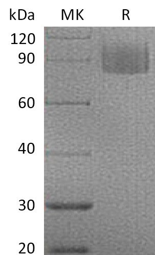 Recombinant Mouse MAG/Siglec-4a Protein (His Tag) - ABMIUM