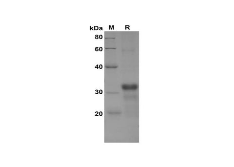 SDS-PAGE analysis of Human Betacellulin/BTC proteins, 2 μg/lane of Recombinant Human Betacellulin/BTC proteins was resolved with SDS-PAGE under reducing conditions, showing bands at 32 kDa.