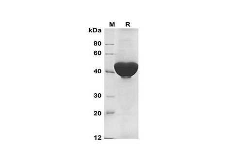 SDS-PAGE analysis of Human UCHL1 proteins, 2 μg/lane of Recombinant Human UCHL1 proteins was resolved with SDS-PAGE under reducing conditions, showing bands at 45 kDa.