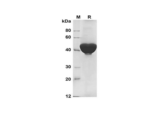 SDS-PAGE analysis of Human UCHL1 proteins, 2 μg/lane of Recombinant Human UCHL1 proteins was resolved with SDS-PAGE under reducing conditions, showing bands at 45 kDa.