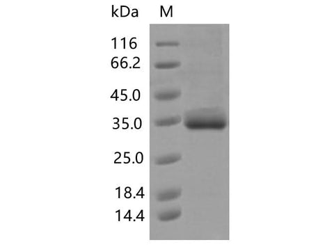 Recombinant SARS-CoV-2 Spike RBD(V483I)(His Tag) - ABMIUM