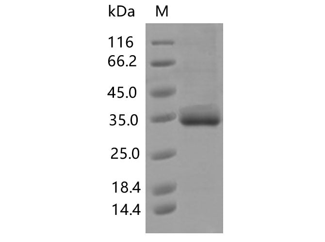 Recombinant SARS-CoV-2 Spike RBD(V483I)(His Tag) - ABMIUM