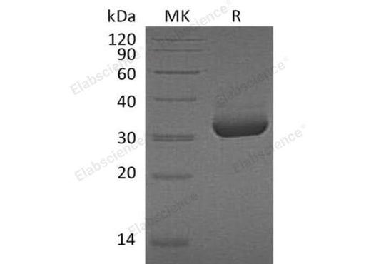 Recombinant Human Mesothelin/MSLN Protein (aa 37-286, His Tag) - ABMIUM
