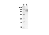 SDS-PAGE analysis of Human F9 proteins, 2 μg/lane of Recombinant Human F9 proteins was resolved with an SDS-PAGE under reducing conditions, showing bands at 50.6 kDa.