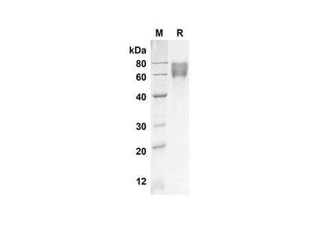 SDS-PAGE analysis of Human F9 proteins, 2 μg/lane of Recombinant Human F9 proteins was resolved with an SDS-PAGE under reducing conditions, showing bands at 50.6 kDa.