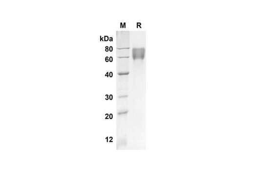 SDS-PAGE analysis of Human F9 proteins, 2 μg/lane of Recombinant Human F9 proteins was resolved with an SDS-PAGE under reducing conditions, showing bands at 50.6 kDa.