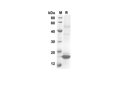 SDS-PAGE analysis of Human IL-10 proteins, 2 μg/lane of Recombinant Human IL-10 proteins was resolved with SDS-PAGE under reducing conditions, showing bands at 19.5 kDa.