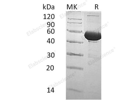 Recombinant Human BPI/CAP57 Protein (His Tag) - ABMIUM