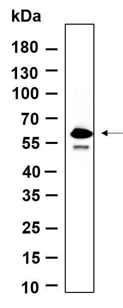 Anti-Human/Mouse/Rat Smad5 Antibody [B590] - ABMIUM