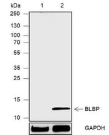 Anti-Human/Mouse FABP7 Antibody [A573]
