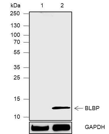 Anti-Human/Mouse FABP7 Antibody [A573] - ABMIUM
