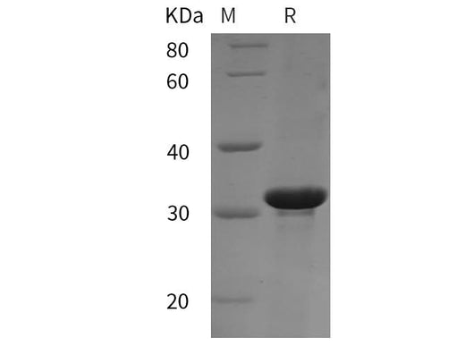 SDS-PAGE analysis of Rat RB1 proteins, 2 μg/lane of Recombinant Rat RB1 proteins was resolved with SDS-PAGE under reducing conditions, showing bands at 32 kDa.