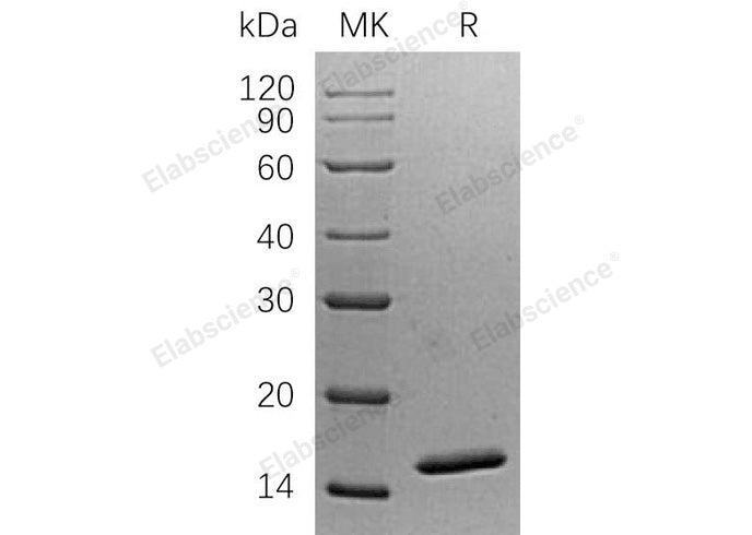 Recombinant Human SNU13 Protein (His Tag) - ABMIUM