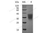 Recombinant Human CD159a/KLRC1 Protein (His Tag) - ABMIUM