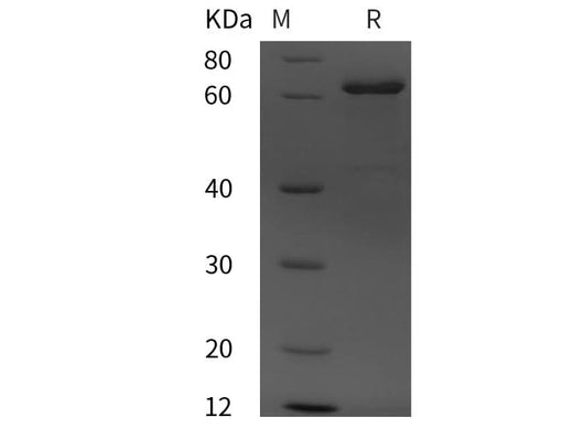 SDS-PAGE analysis of Human Alpha-Fetoprotein/AFP proteins, 2 μg/lane of Recombinant Human Alpha-Fetoprotein/AFP proteins was resolved with SDS-PAGE under reducing conditions, showing bands at 68 kDa.