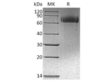 Recombinant Human EGFR/ErbB1 Protein (His & Avi Tag) - ABMIUM