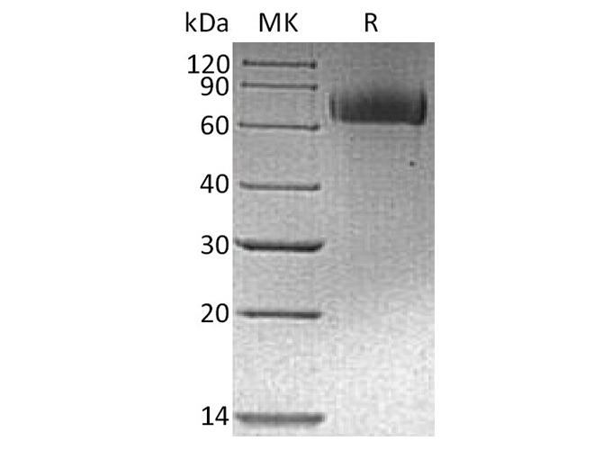 Recombinant Human EGFR/ErbB1 Protein (His & Avi Tag) - ABMIUM