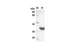 SDS-PAGE analysis of Human G-CSF proteins, 2 μg/lane of Recombinant Human G-CSF proteins was resolved with an SDS-PAGE under reducing conditions, showing bands at 39.5 kDa.