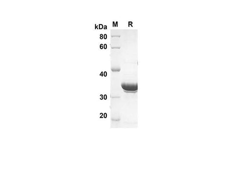 SDS-PAGE analysis of Human G-CSF proteins, 2 μg/lane of Recombinant Human G-CSF proteins was resolved with an SDS-PAGE under reducing conditions, showing bands at 39.5 kDa.
