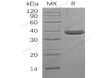 Recombinant Human LDH-A/LDHA Protein (His Tag) - ABMIUM