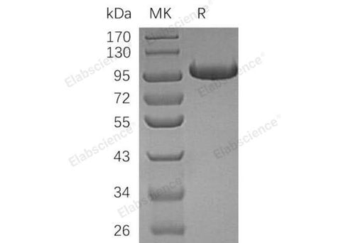 Recombinant Human Complement Factor B/CFB Protein (His Tag) - ABMIUM