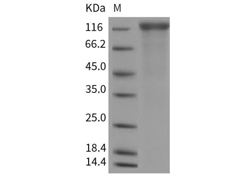Recombinant Rat VEGFR2/CD309/KDR Protein (His Tag) - ABMIUM