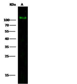 Anti-Human PDGFRA Antibody [A866] - ABMIUM