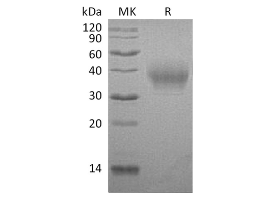 Recombinant Rabbit B7-1/CD80 Protein (His Tag) - ABMIUM