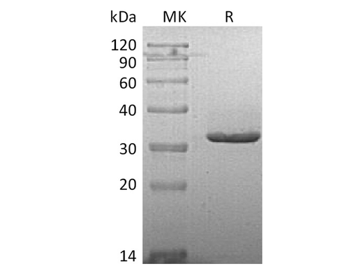 Recombinant Human IgG2-Fc Protein - ABMIUM