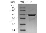 Recombinant Human Carbonic Anhydrase 8/CA8 Protein (His Tag) - ABMIUM
