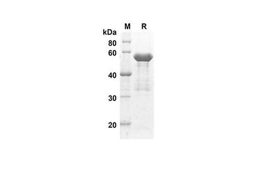 SDS-PAGE analysis of Human ACE2 proteins, 2 μg/lane of Recombinant Human ACE2 proteins was resolved with SDS-PAGE under reducing conditions, showing bands at 51.2 kDa.