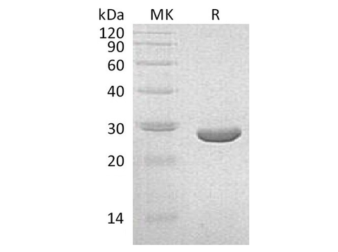 Recombinant Klebsiella pneumoniae NEO Protein - ABMIUM