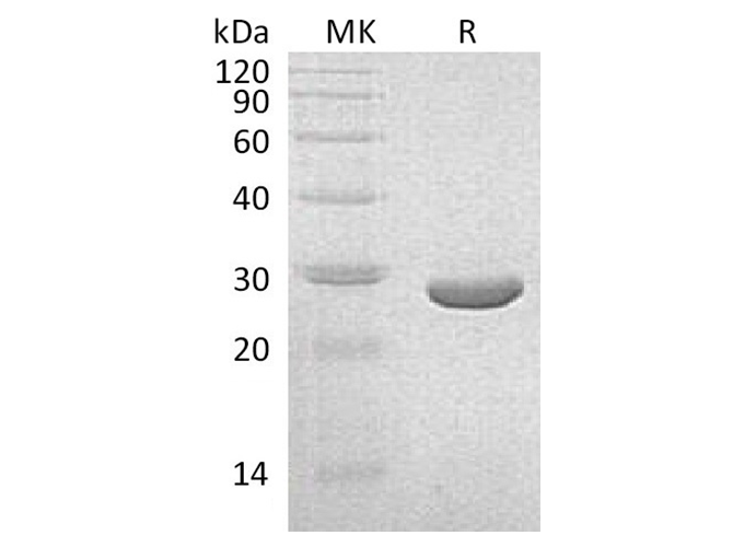 Recombinant Klebsiella pneumoniae NEO Protein - ABMIUM