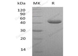 Recombinant Human Nectin-4/NECTIN4 Protein (His Tag) - ABMIUM