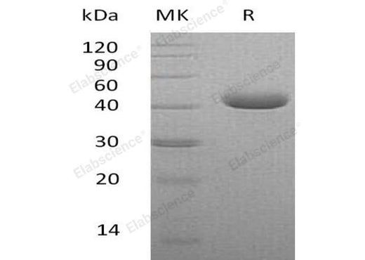 Recombinant Human Nectin-4/NECTIN4 Protein (His Tag) - ABMIUM