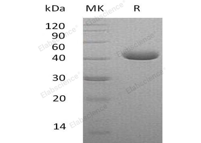 Recombinant Human Nectin-4/NECTIN4 Protein (His Tag) - ABMIUM