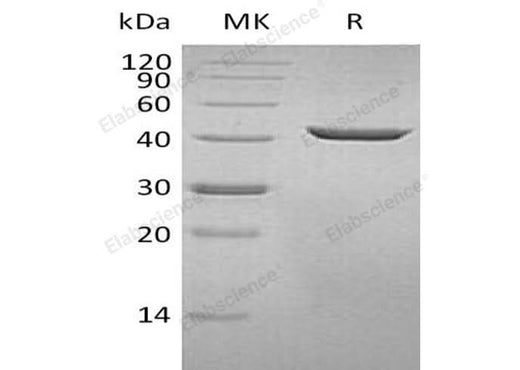 Recombinant Human SEPHS1 Protein (His Tag) - ABMIUM