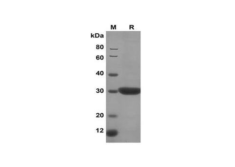 SDS-PAGE analysis of Human S100A9 proteins, 2 μg/lane of Recombinant Human S100A9 proteins was resolved with SDS-PAGE under reducing conditions, showing bands at 30 kDa.