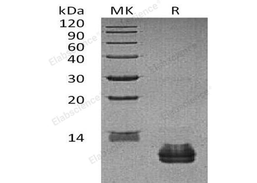 Recombinant Human CCL27 Protein - ABMIUM