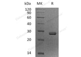 Recombinant Human PDCD10/TFAR15 Protein - ABMIUM