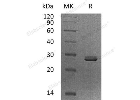 Recombinant Human PDCD10/TFAR15 Protein - ABMIUM