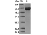 Recombinant Human Cbl-c/CBL-3 Protein (His & GST Tag) - ABMIUM