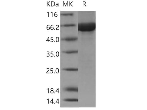Recombinant Human Cbl-c/CBL-3 Protein (His & GST Tag) - ABMIUM