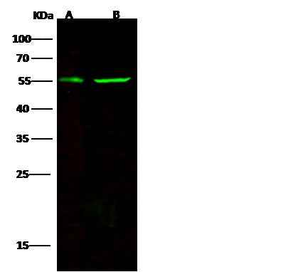 Anti-Human CD83 Antibody [A1123] - ABMIUM