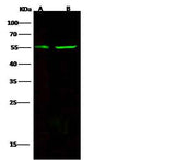Anti-Human CD83 Antibody [A1123] - ABMIUM